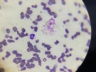 猫鼻支是怎么诊断的，又该怎么办呢？|猫鼻支治疗方法一览