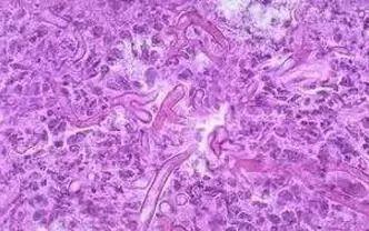 女性阴道炎怎么办？做好这些事，远离难“炎”之隐