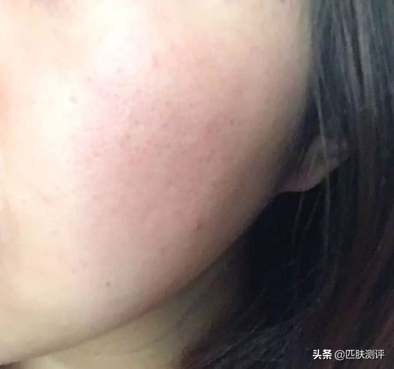 激光美容仪推荐,家用激光美容仪测评