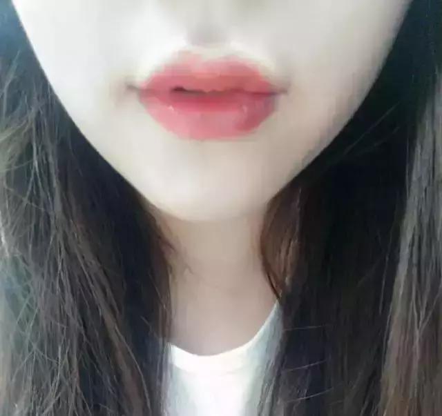 你知道什么是玻尿酸吗,如何快速了解玻尿酸品类