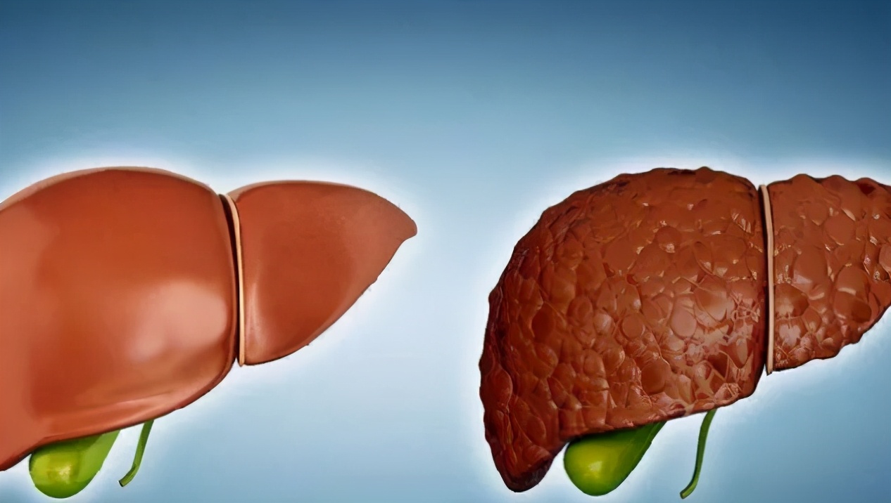 身上长了红色的蜘蛛点怎么回事,身上有蜘蛛红点