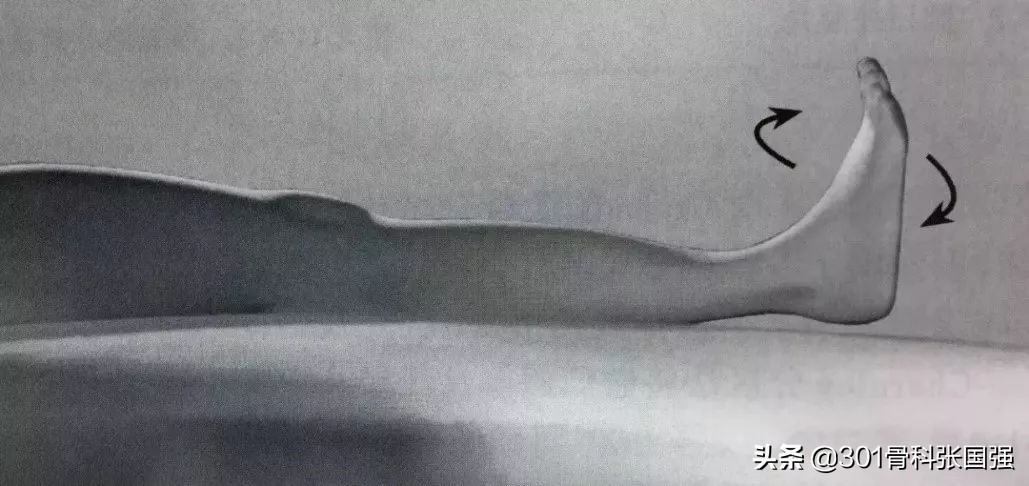 膝关节置换后血栓如何康复训练,膝关节置换后预防血栓的药吃多久