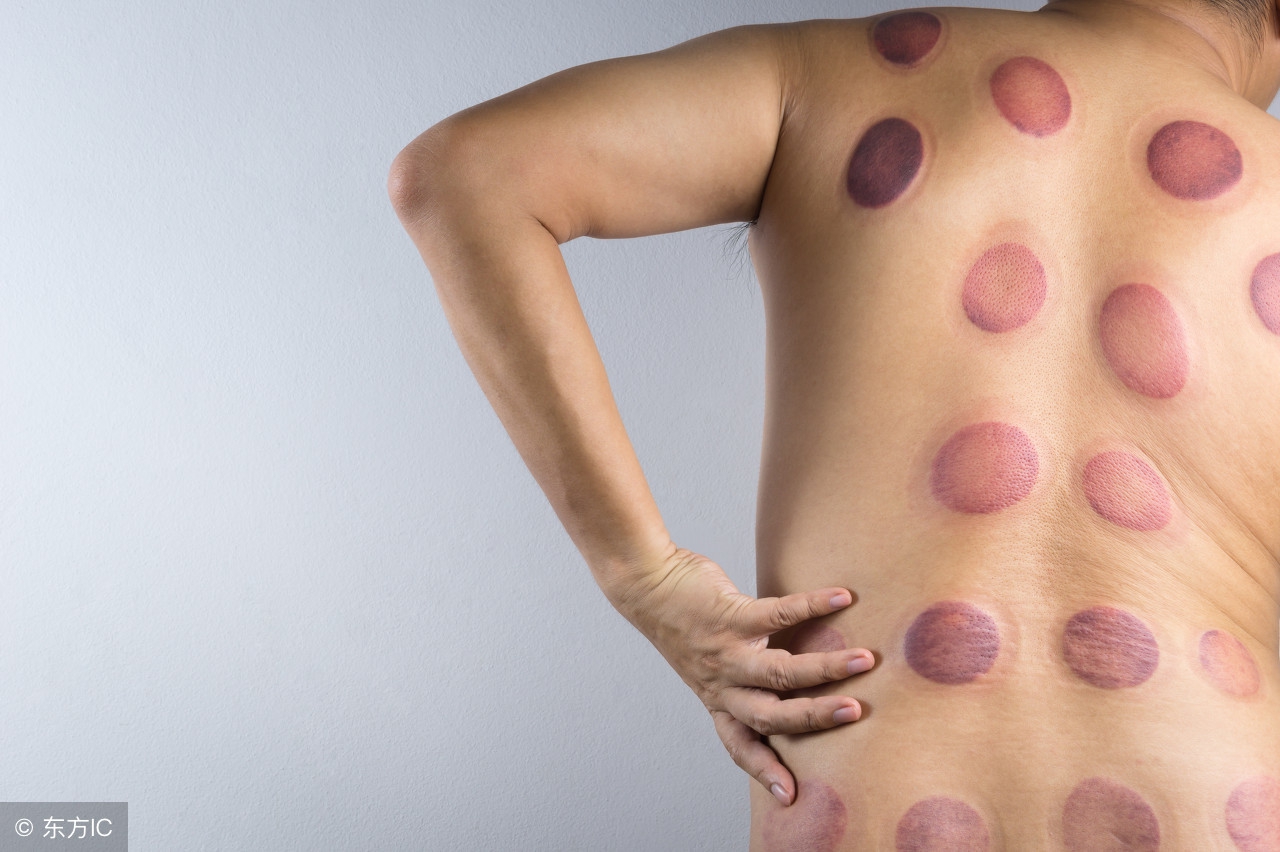 拔罐舒服吗有什么用,拔罐很舒服