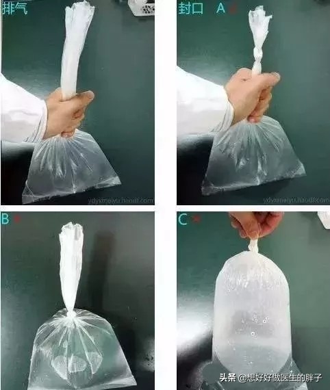 有痛风脚一直隐隐作痛,有痛风脚是不是很冰凉