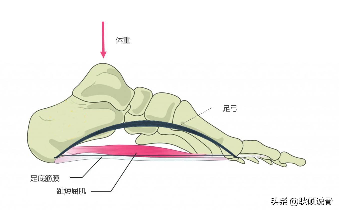 足底筋膜炎居家保健,足底筋膜炎平时走路的技巧