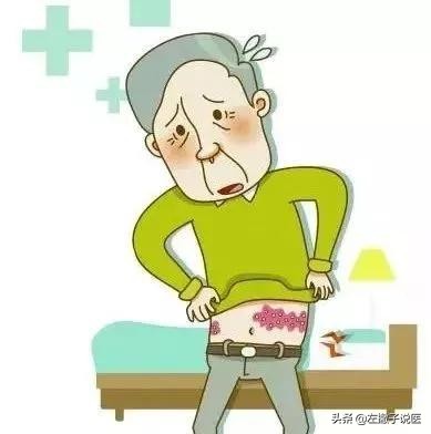 蛇缠腰是很恐怖的病吗,蛇缠腰传言