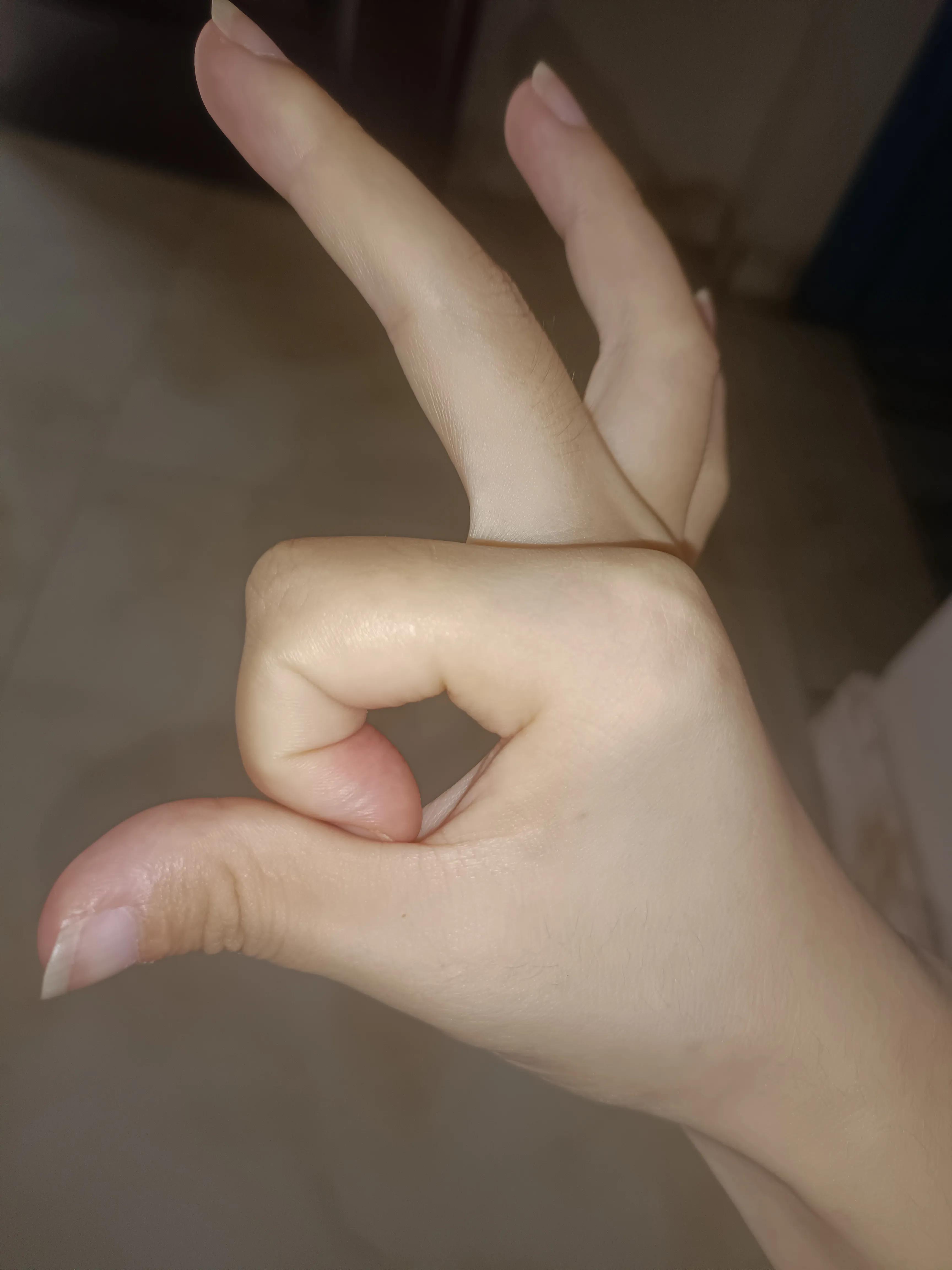 治疗脱发断发的方法,脱发和断发的区别图