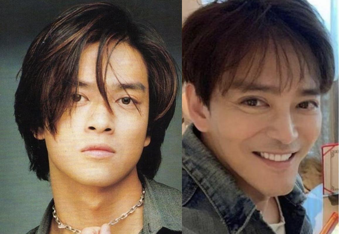 老演员整容脸变形,老年人整容前后照片