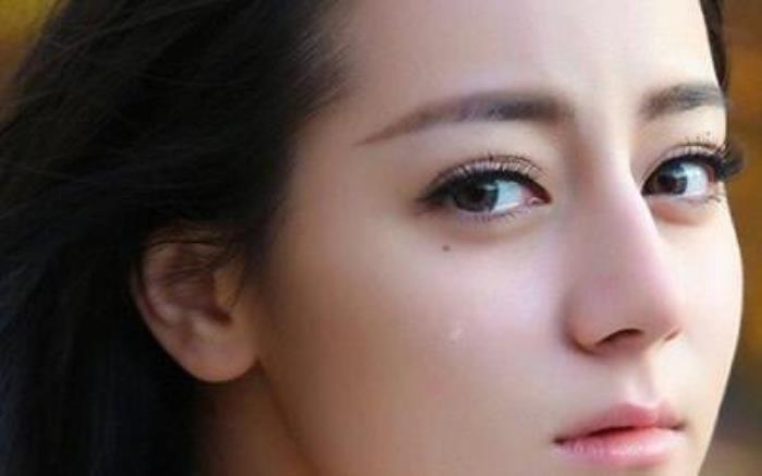 面部祛痣哪些痣不能去,祛痣的负面效果