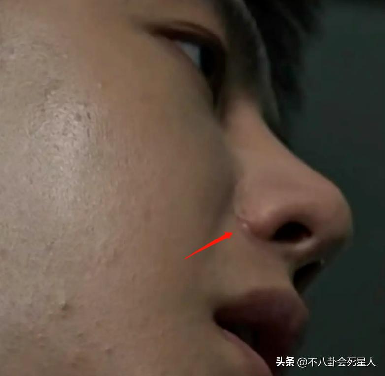 演员假发套穿帮,假发穿帮镜头