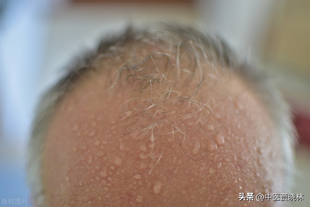 送你四种阴阳双补的中成药，帮你助阳、固本、补肾、填精