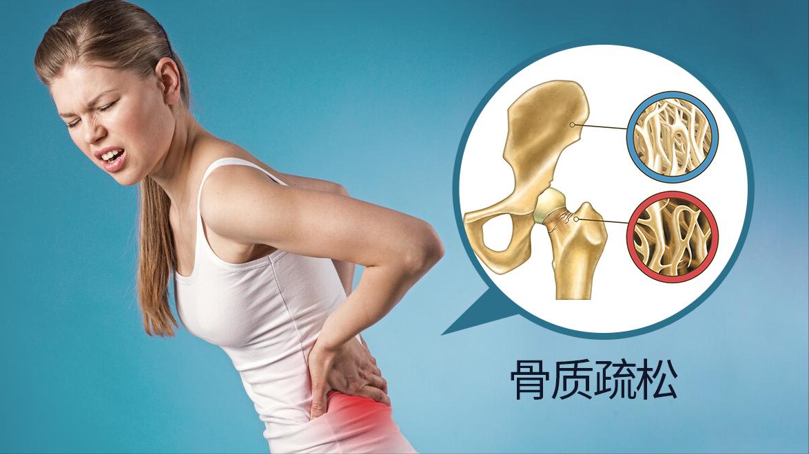 老人摔了后如何饮食,老人为什么一摔跤就骨折