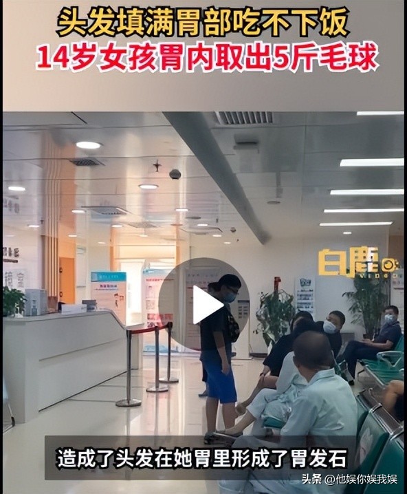 心疼西安这位14岁留守女孩，吃自己头发让胃积满5斤毛球