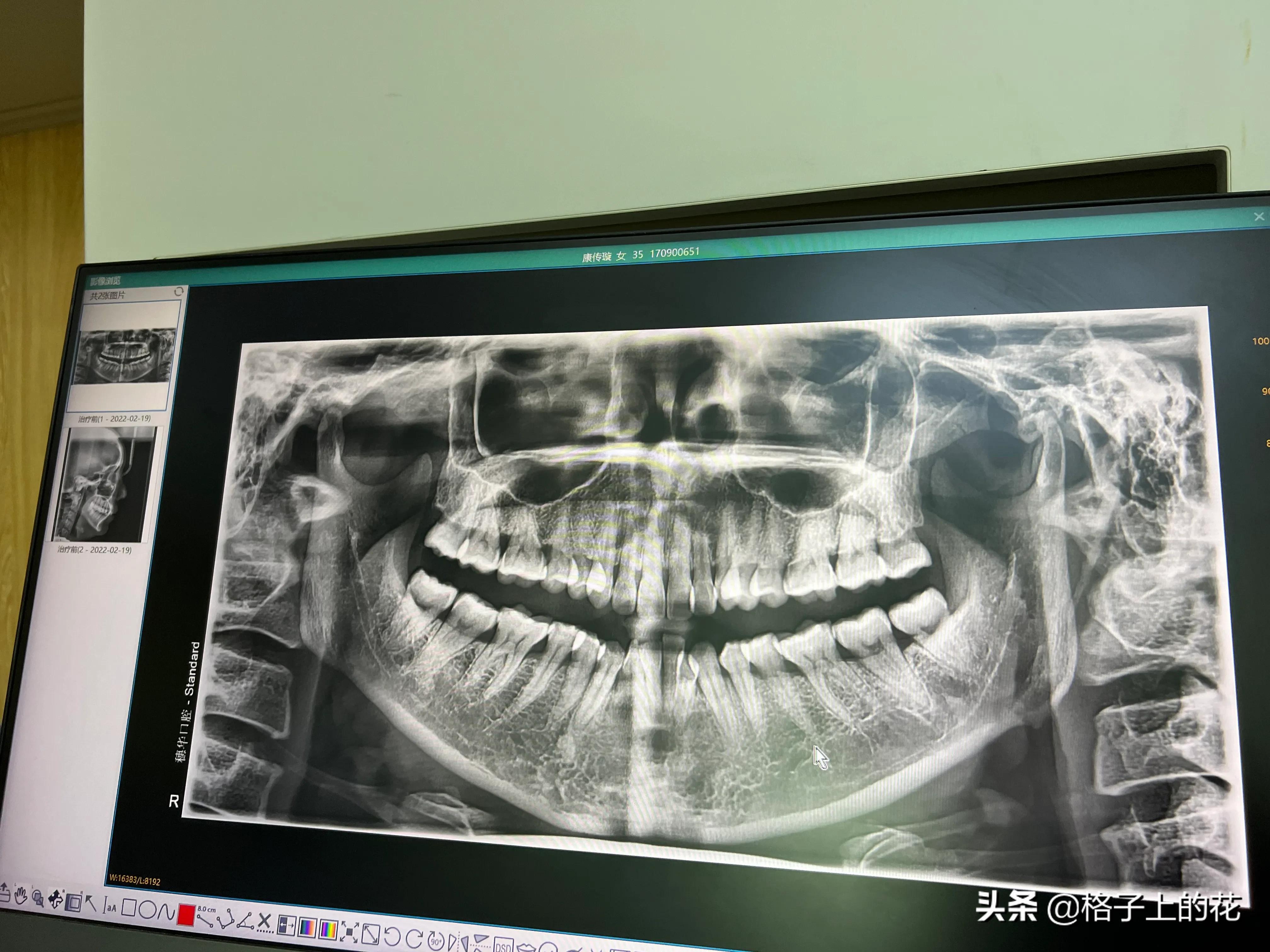 广州市正规的口腔医院,广州比较正规的口腔医院