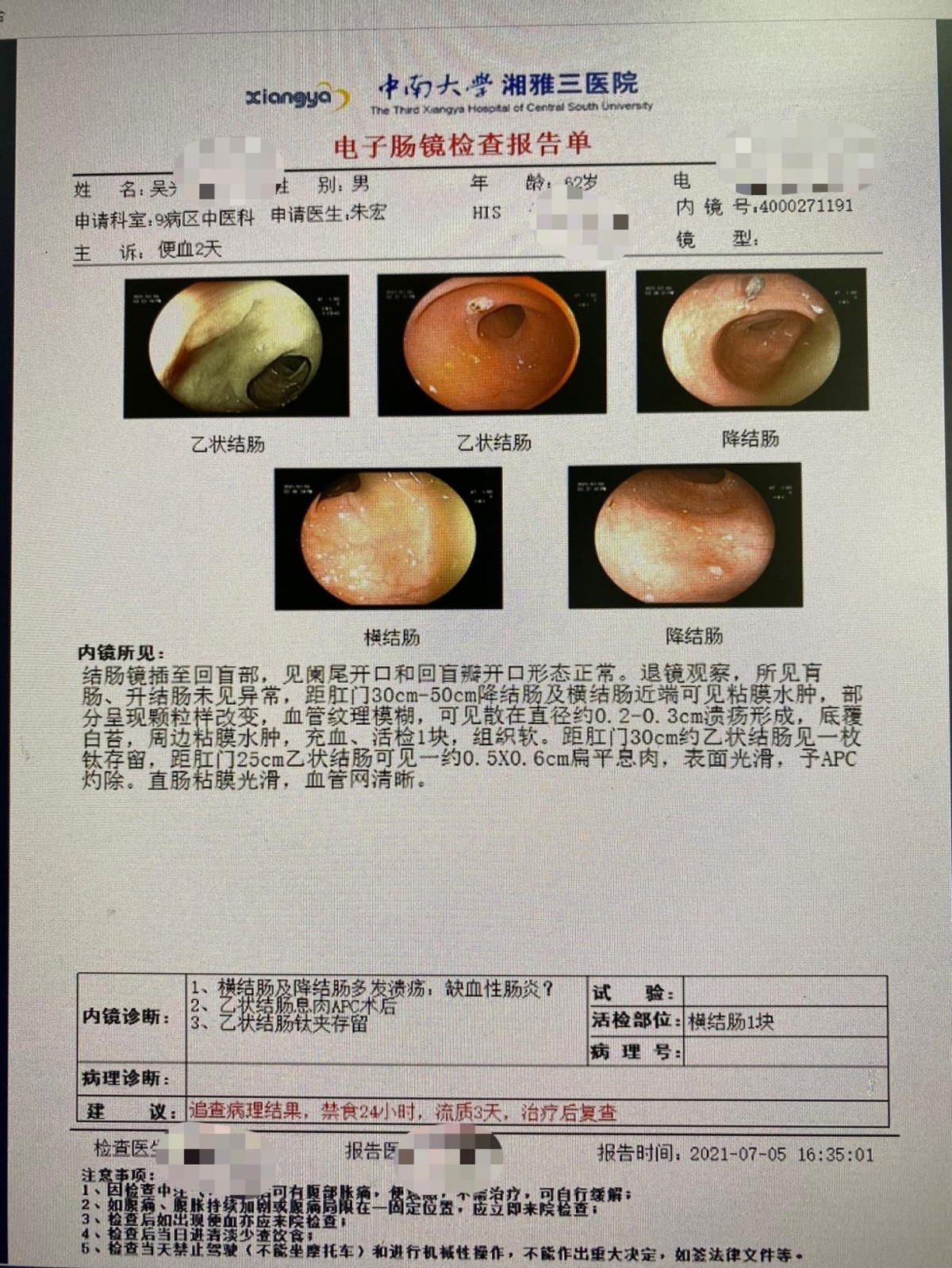 老年人缺血性肠炎,缺血性肠炎出血怎么治疗