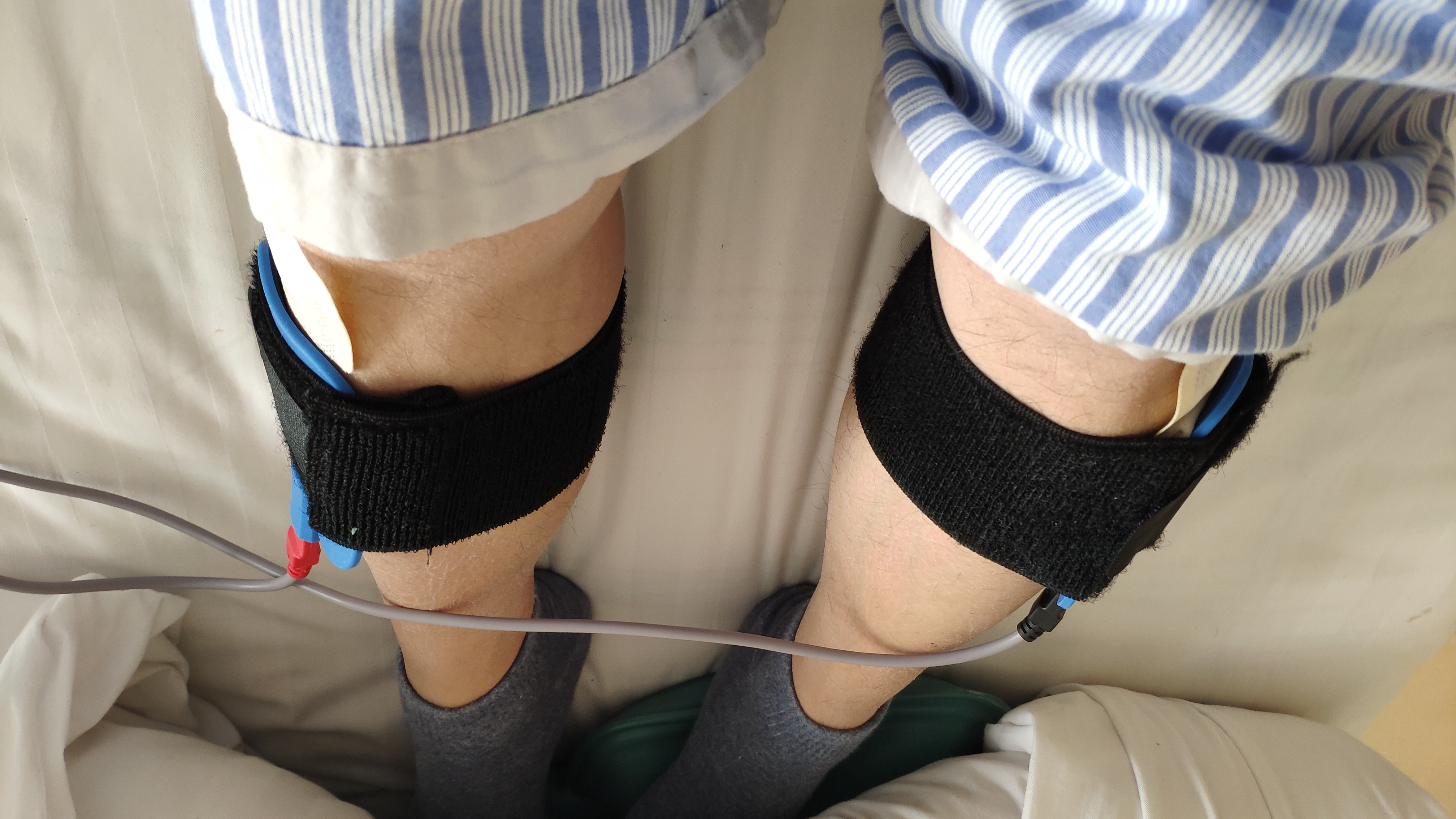 痔疮手术笔记怎么写,痔疮手术换药患者自述