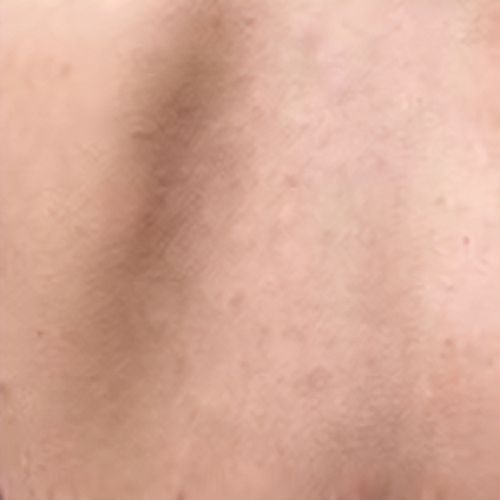 背部爱长痘痘是什么原因,背部面部长痘的原因