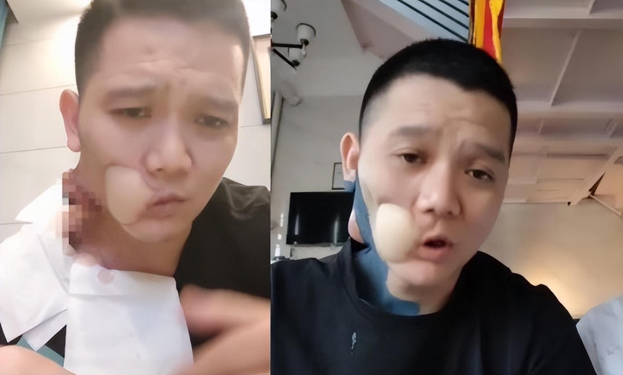 湖南籍歌手因口腔癌去世享年36岁曾劝网友远离槟榔