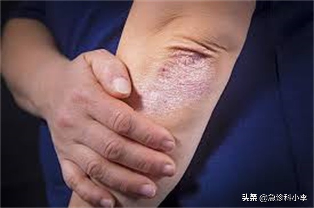 5种病治也治不好,5种疾病不建议过度治疗