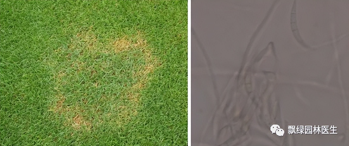 草坪发黄发枯是什么原因,草坪出现枯黄病怎么治理