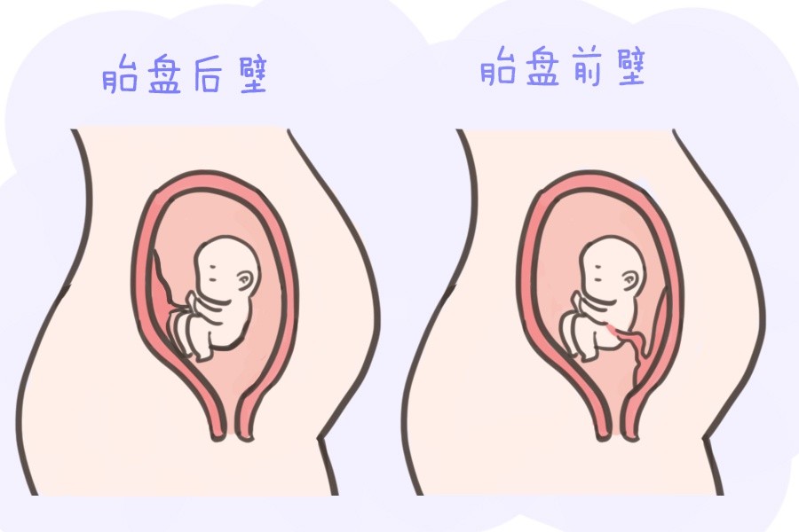 怀孕前壁和后壁是指前怀和后怀吗,怀孕前壁和后壁的区别上下怀
