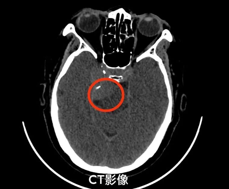 皇冠上的明珠劳斯莱斯,皇冠上的明珠原文
