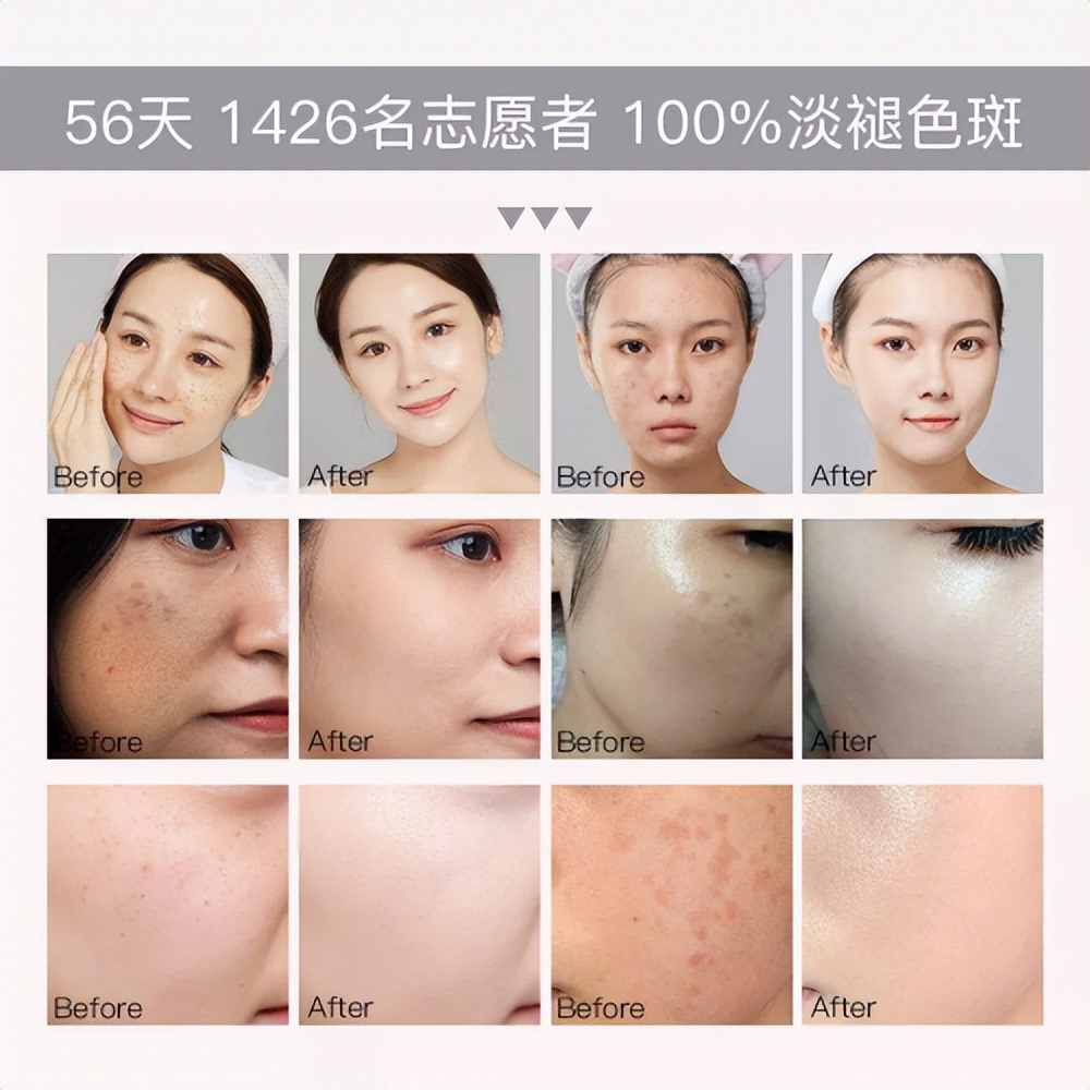 美白祛斑精华霜十大排名最新款,美白祛斑精华液十大排名