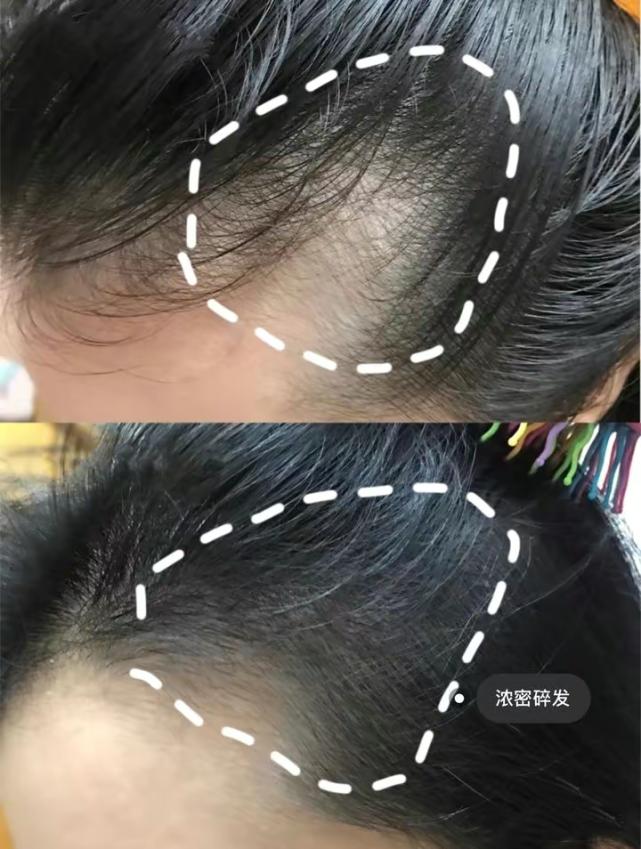 好用洗发水推荐防脱发生发留香,全网最好用的洗发水防脱发的