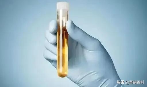 肌酐升高以后最怕肾友做3件事,肌酐升高怎么食疗