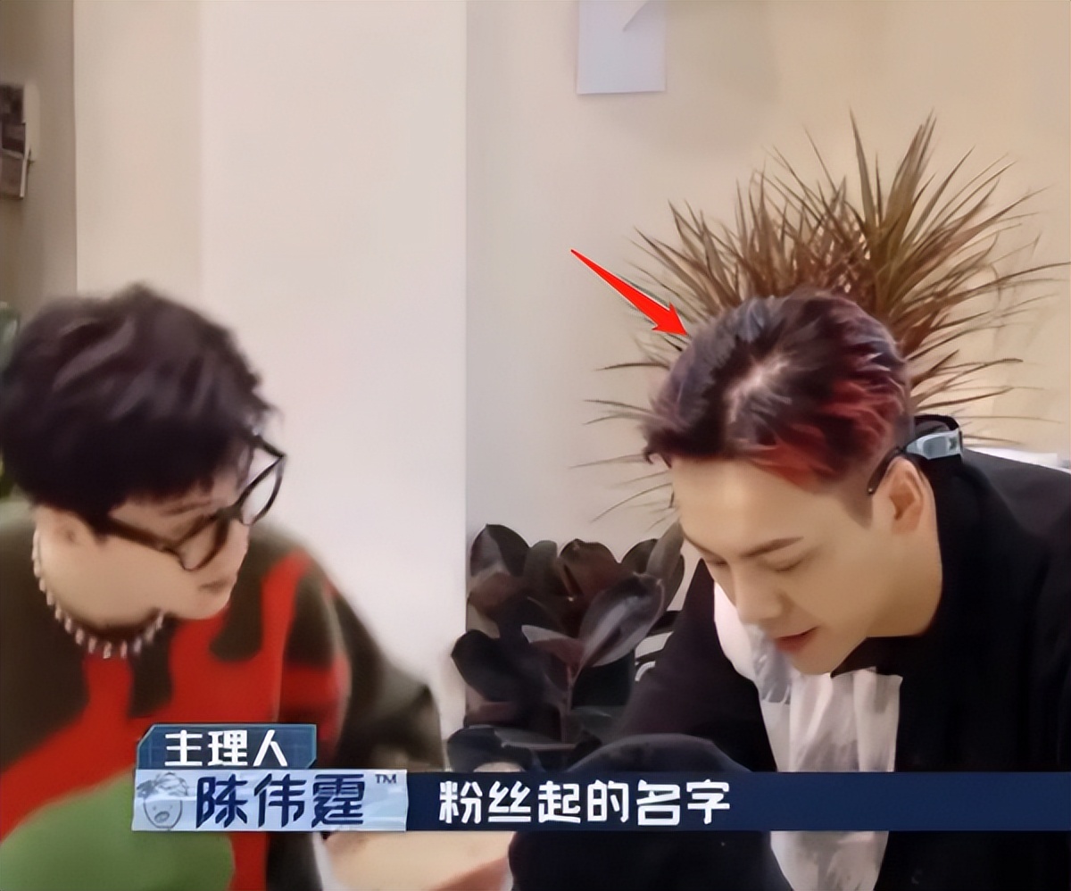 周杰伦黄晓明沙溢吴彦祖聂远,黄晓明周杰伦头发稀疏