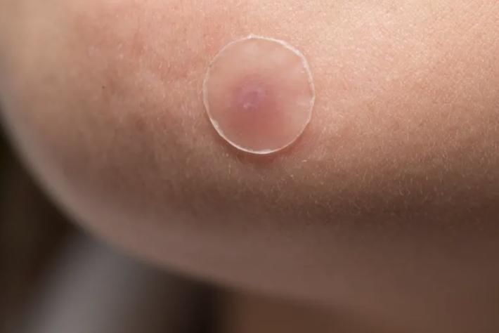 韩国美容新趋势,韩国整形美容发展趋势