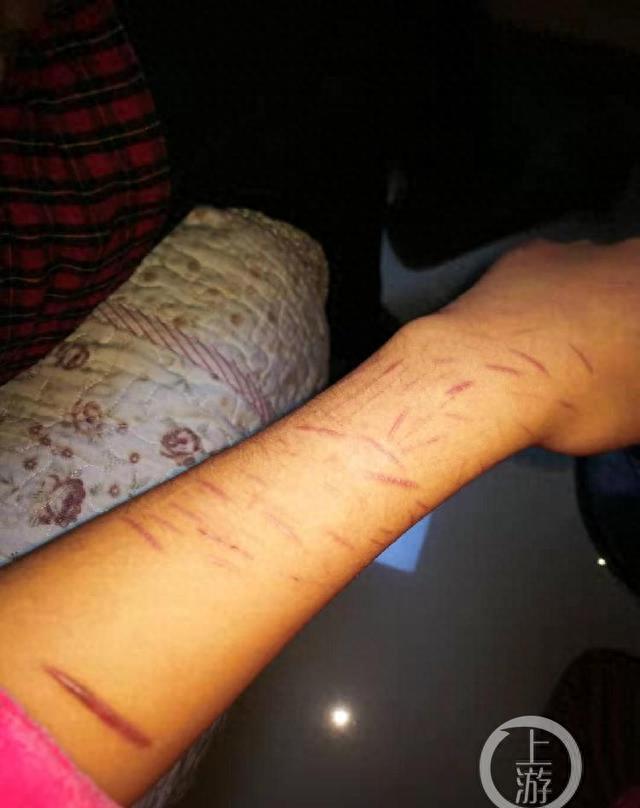 14岁少女疑遭学长引诱，服150粒药自杀：“他强奸我，全身散了”