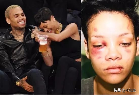 一双价值两亿天价的腿你们看过吗,一双价值2亿的双腿