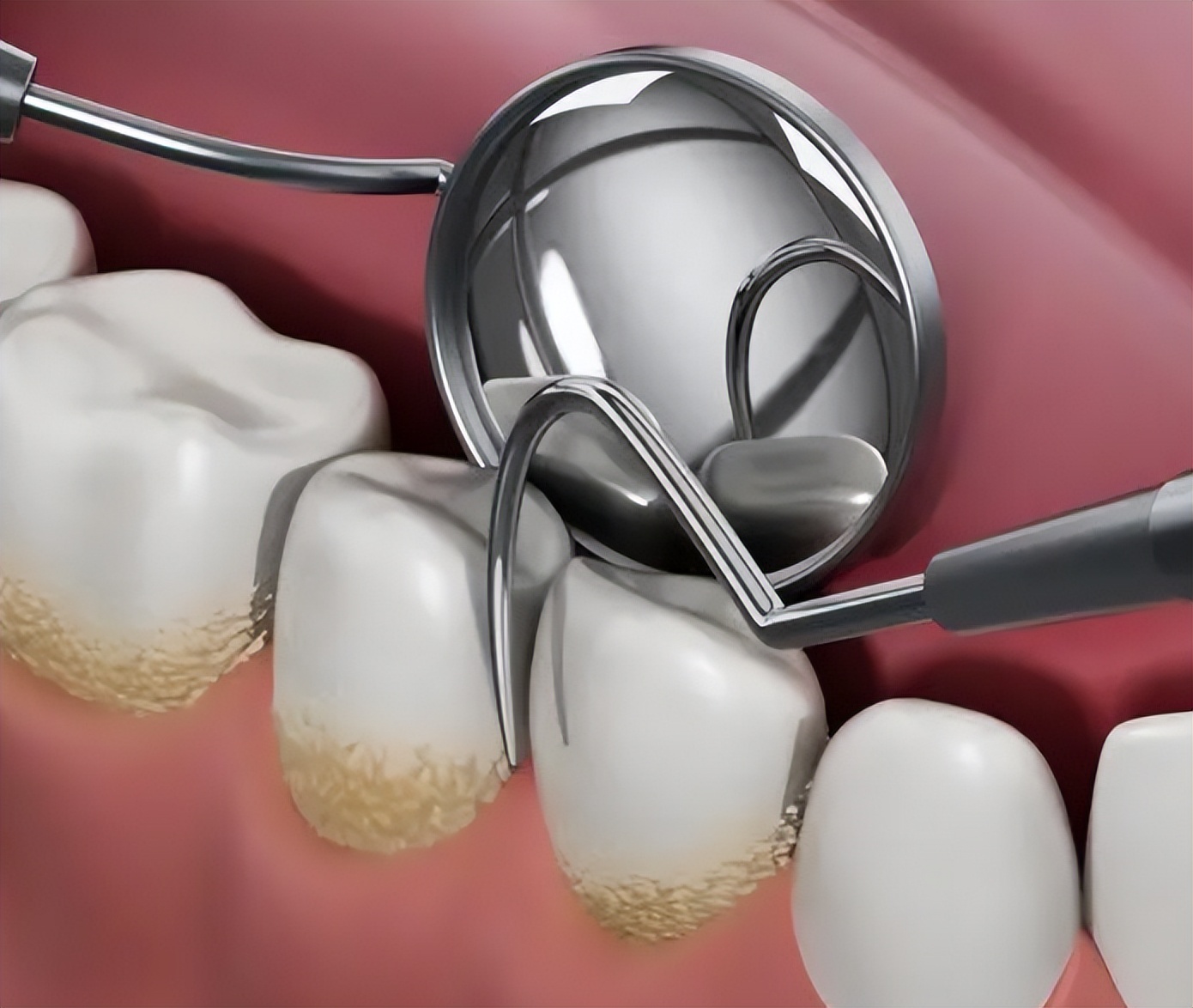 怎么快速缓解口腔溃疡的痛苦,嘴里长口腔溃疡怎么治好得快