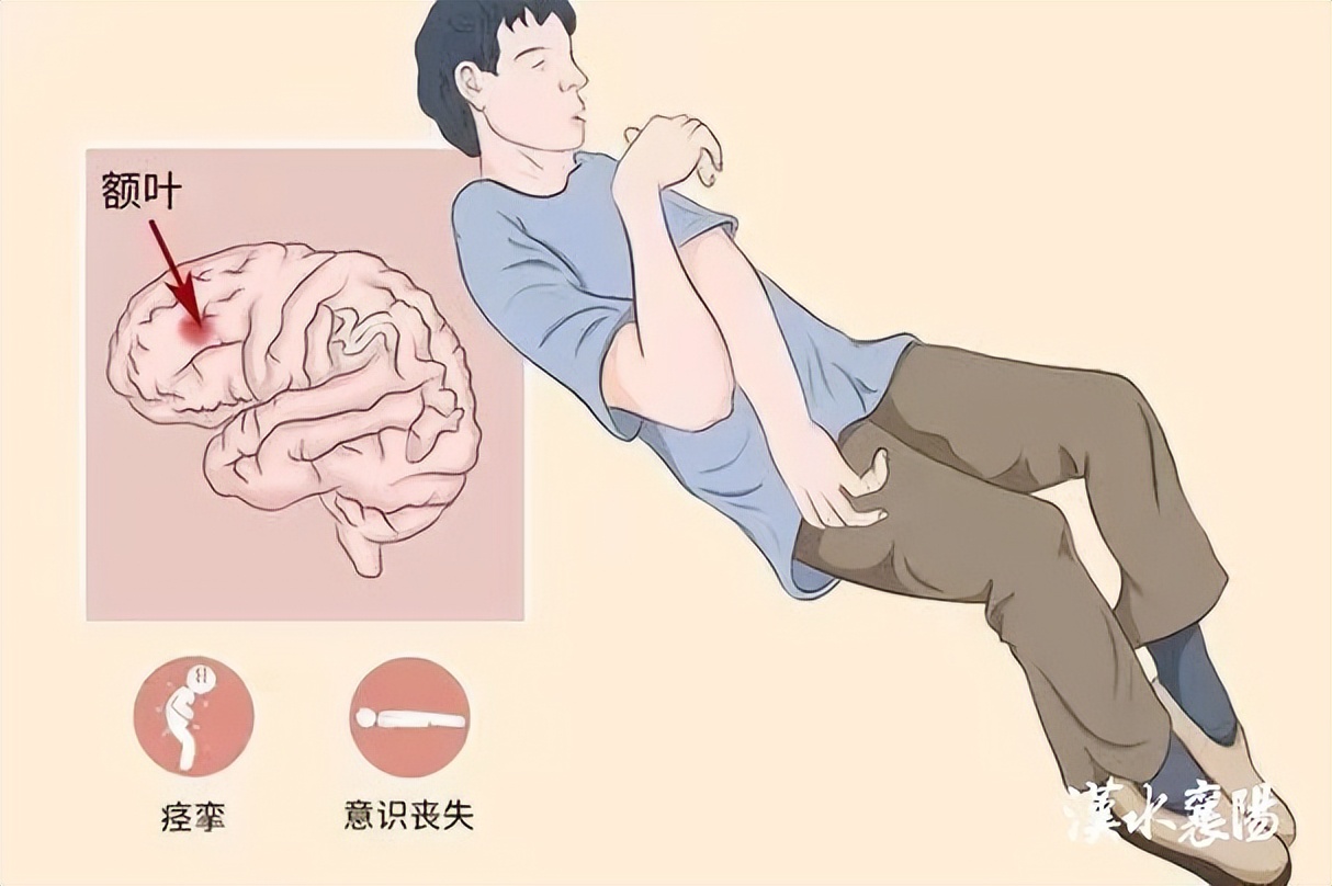 癫痫和惊厥的相关知识,高热惊厥与癫痫病的区别