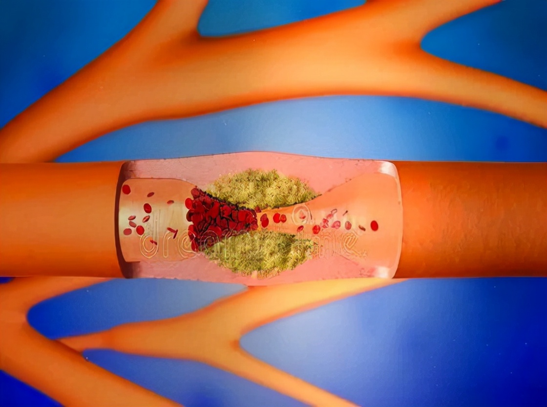 肝硬化身上长小红点痒是什么征兆,肝硬化脚面出了好多小红点有点肿