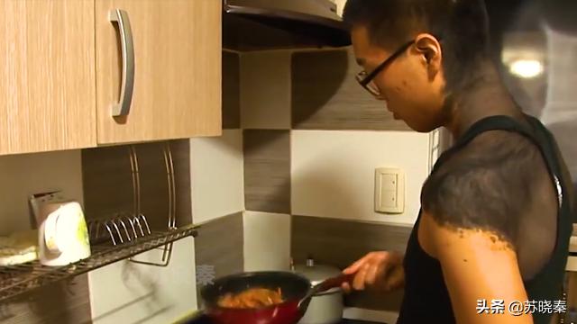 小伙背上长痣,男子背上有痣好不好