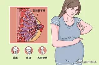 哺乳期涨奶怎么办,哺乳期奶胀的解决方法