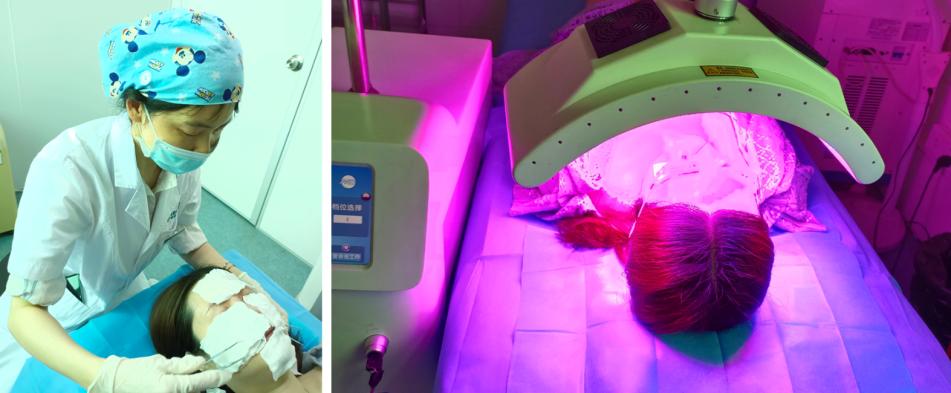 中年妇女面部色斑爆发怎样消除,女性色斑的最佳治疗方法