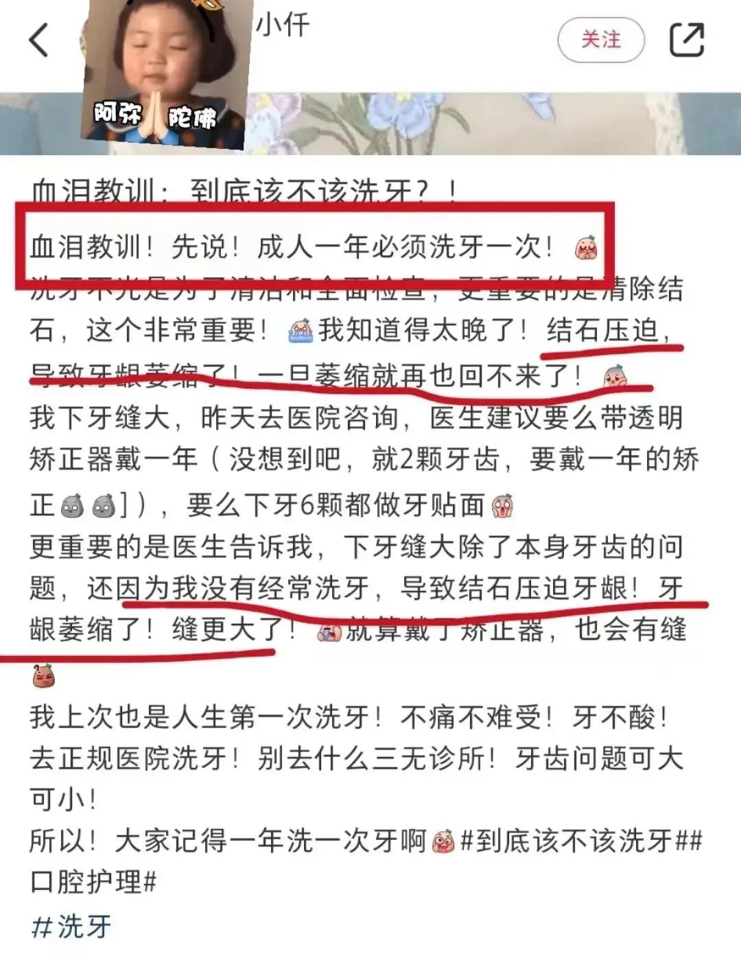 电动冲牙器便携式深层清洁牙齿,牙刷电动软毛护牙