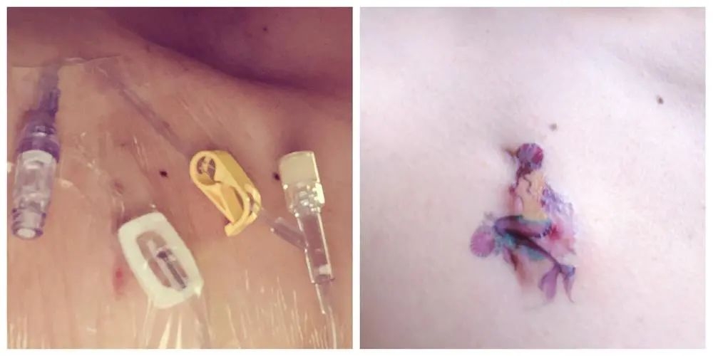 一家四口得癌症她们是这样度过的,父母检查出癌症晚期怎么处理