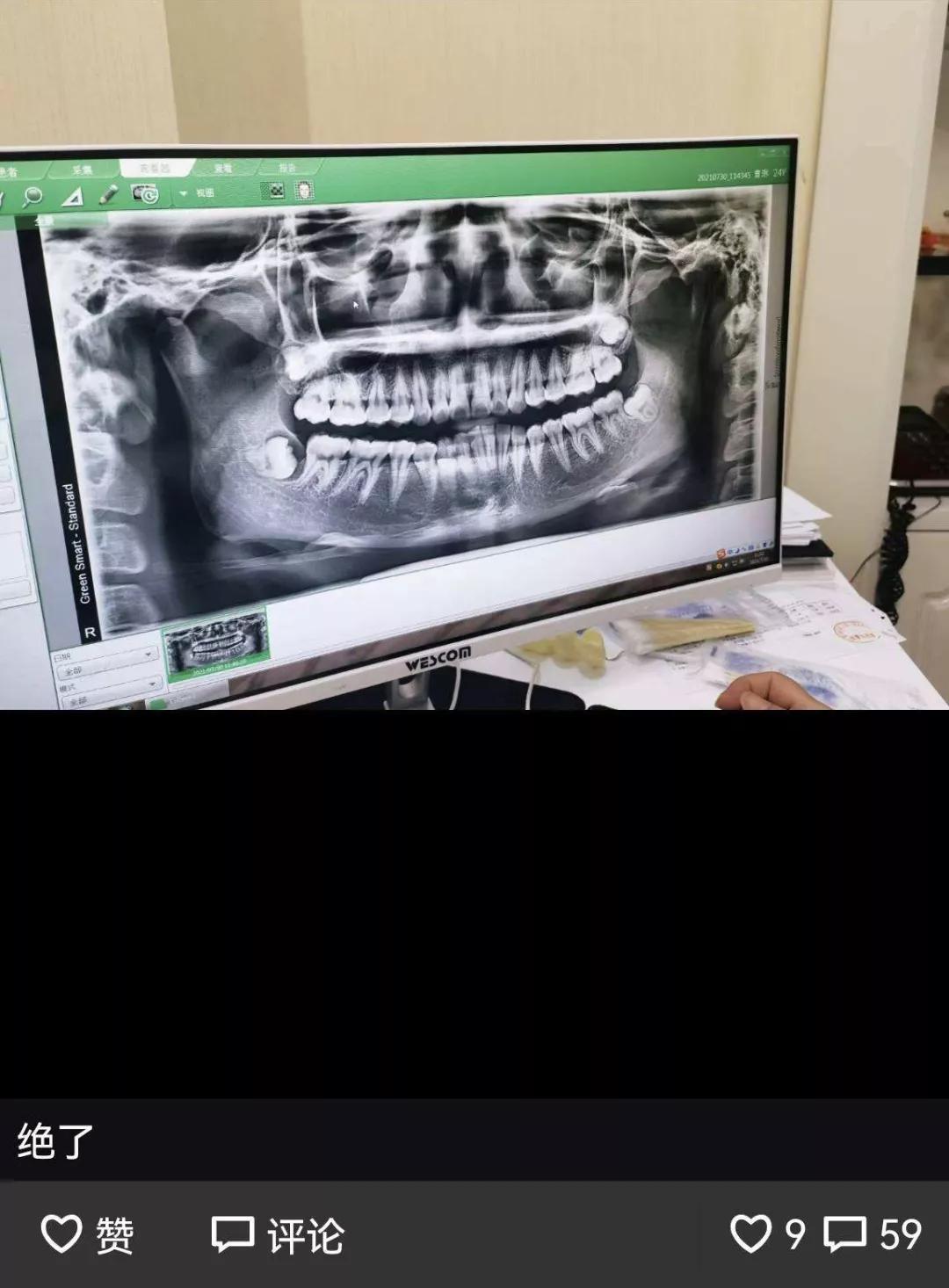 这是你最想公开给前任的朋友圈