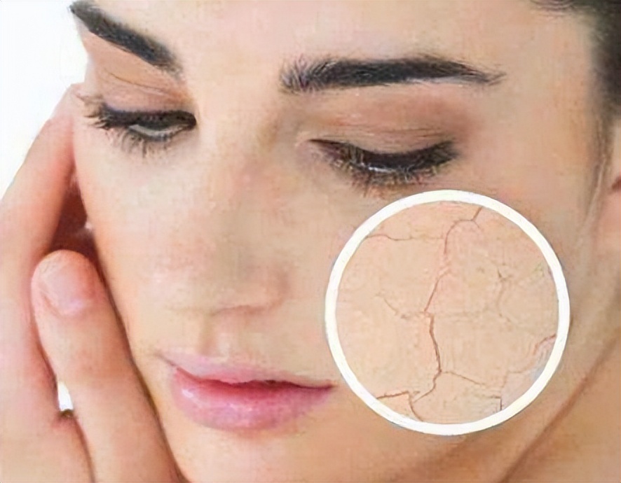 40多岁皮肤干燥用什么面霜好,40岁女人护肤品面霜200以下