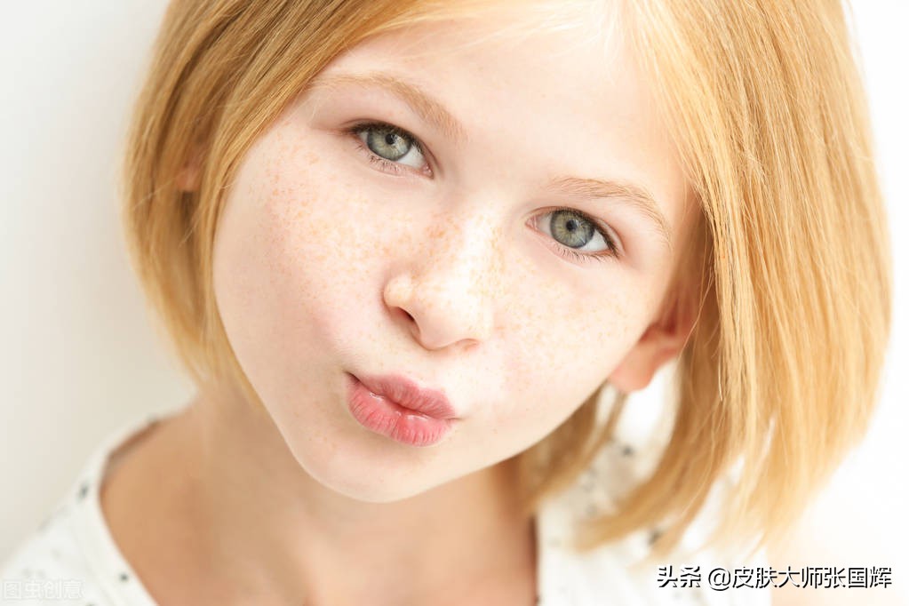 色斑严重怎么调理淡化色斑,怎么样分别表皮色斑还是真皮色斑