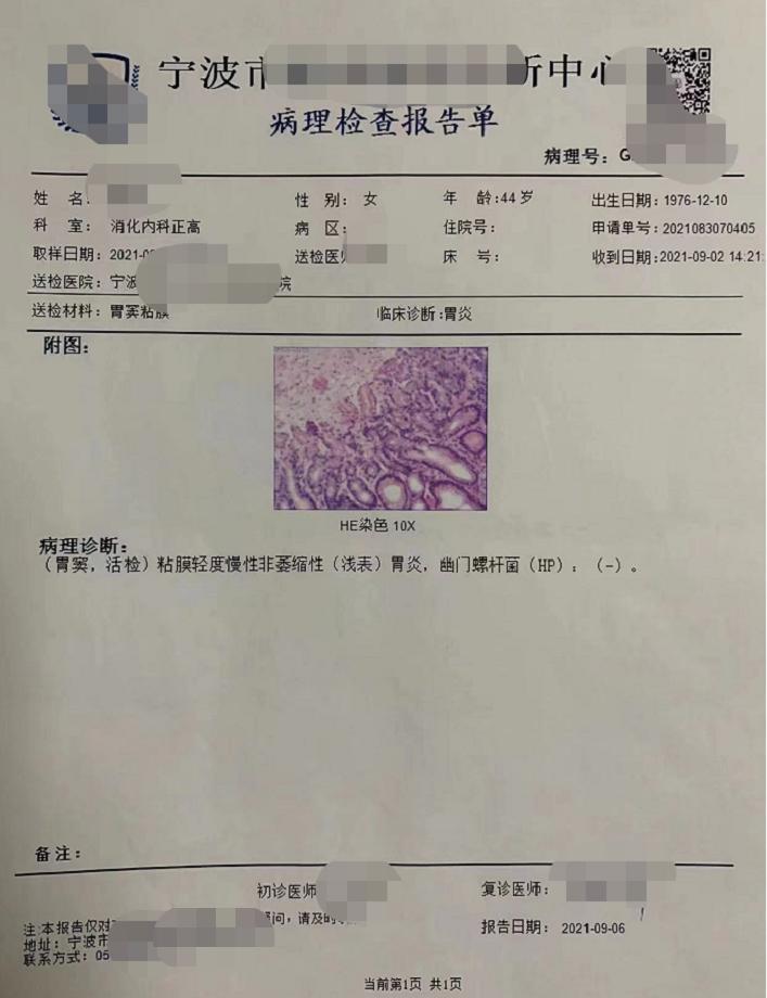 不吃一粒西药,用药线点灸治愈慢性萎缩性胃炎伴肠化生(附病案)