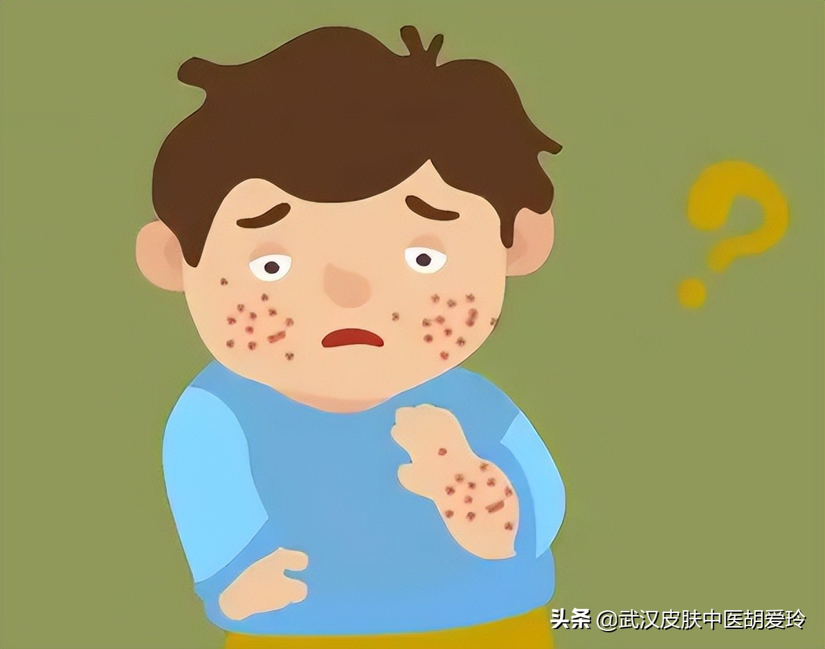 疙瘩最快消除方法,湿疹小疙瘩如何快速消除