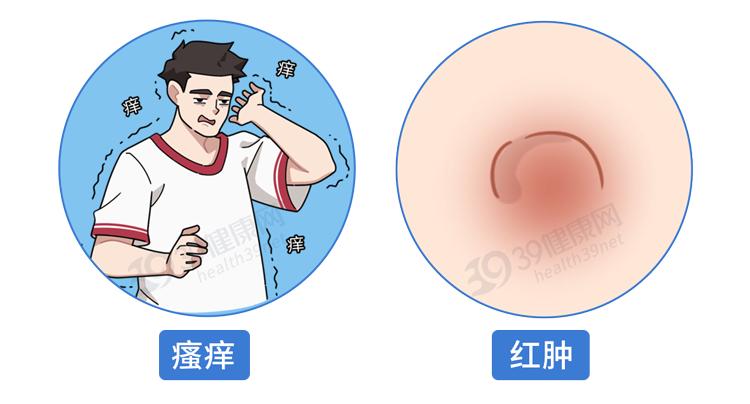 阿莫西林要认清只对这4种病有效,阿莫西林别乱吃只对哪四种病有效