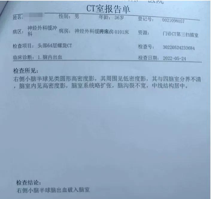 80后中年脑出血,80后脑出血患者