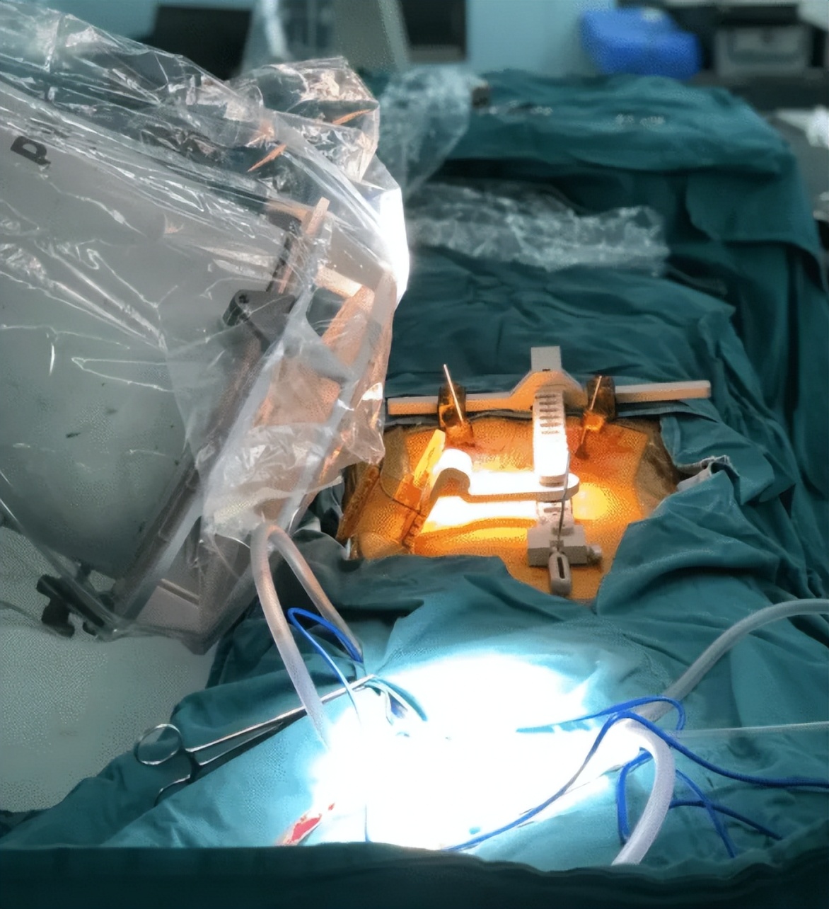 外科医用手术电钻,电外科手术器械有哪些