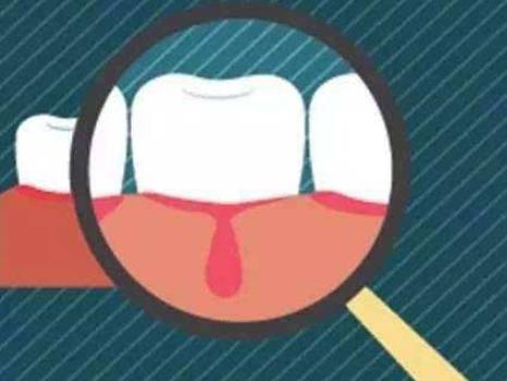 电动牙刷能去掉牙齿上的黑渍吗,小孩用电动牙刷会导致牙齿脱矿吗